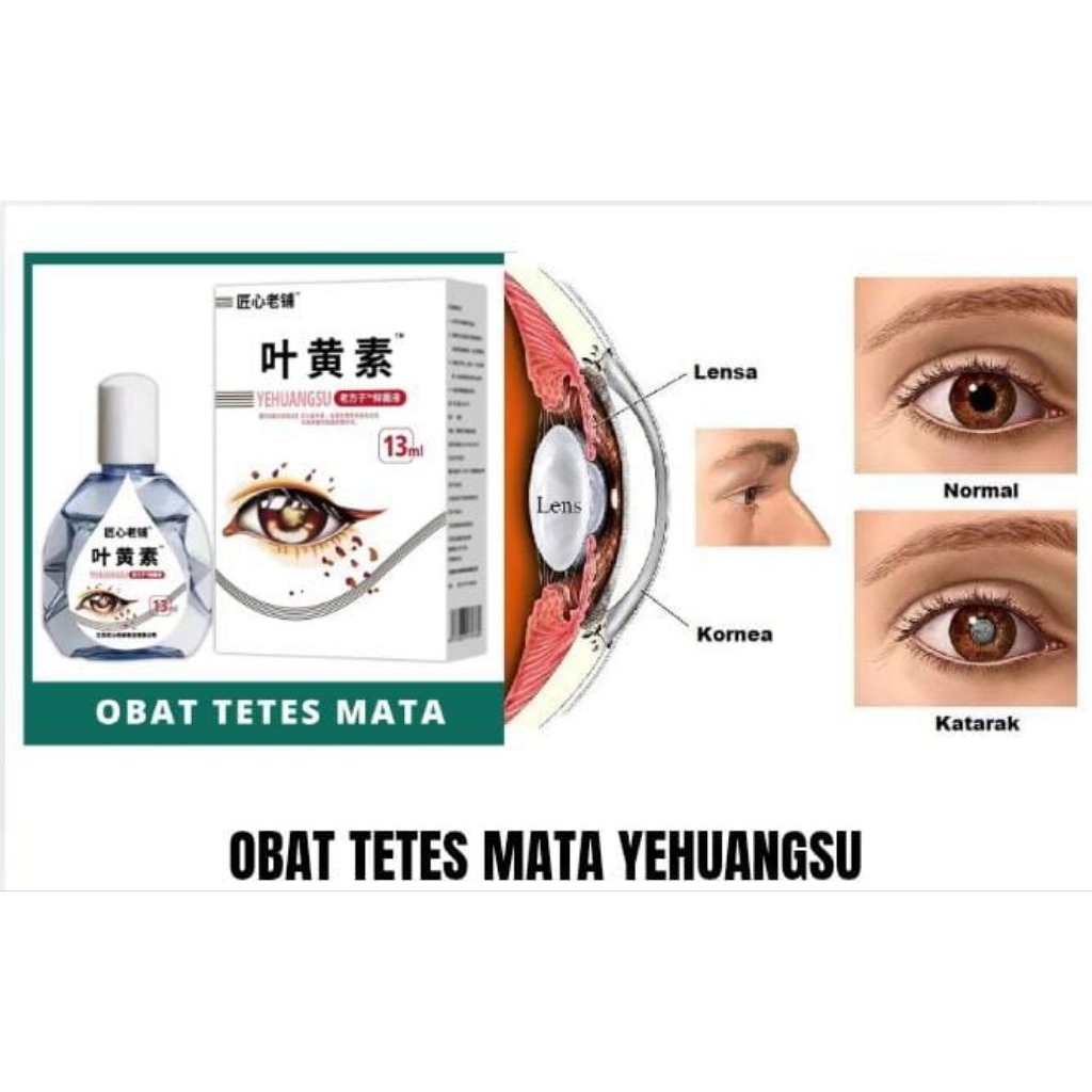 TETES MATA No 1 Di Jepang Solusi Mata Lelah, Mata Kering, Mata Merah Dan Iritasiringan