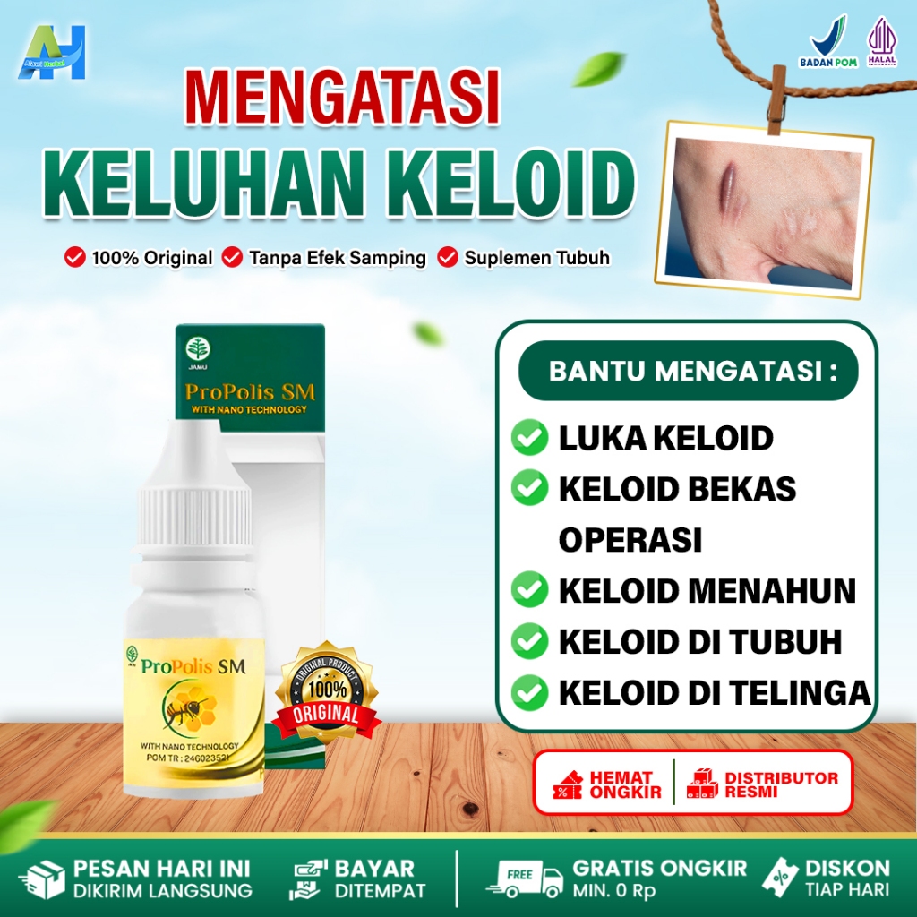 Obat Keloid, keloid Menahun, keloid Luka tindik, Penghilang keloid daging tumbuh, keloid daging tumb