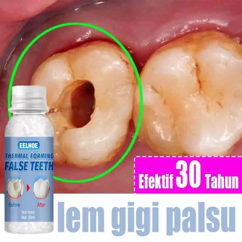 Penambal gigi berlubang gigi palsu asli dokter permanen tambal gigi permanen 30ML lem gigi palsu per