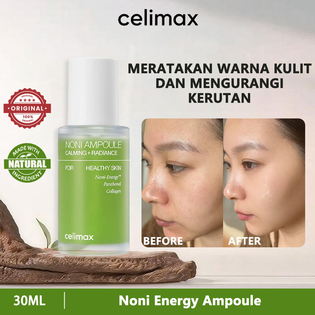 Celimax Noni Ampoule Calming Radiance Serum 30ml/celimax Noni Energy Ampoule 30ml