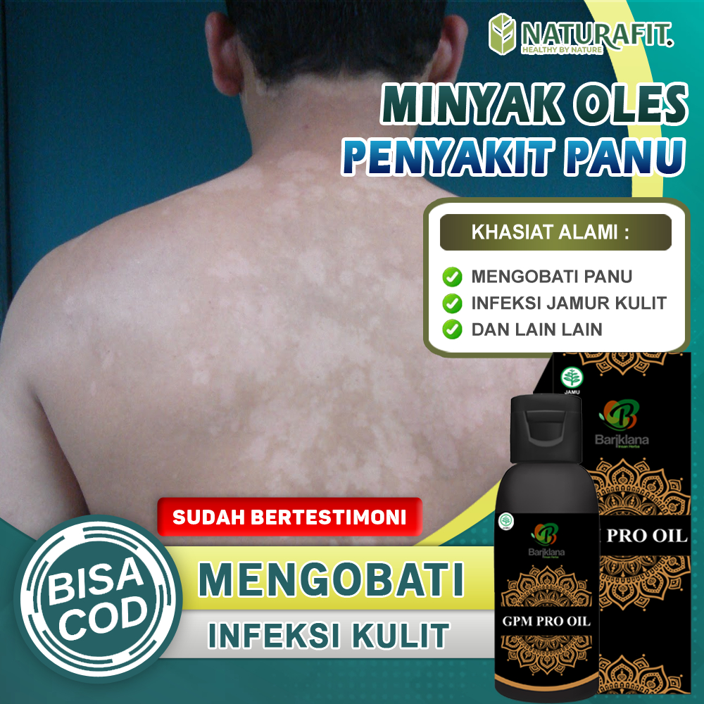 Obat Panu Paling Ampuh Minyak Oles Jamur Kulit Panuan Penghilang panu Kurap Gatal Hapuran Salep Bala