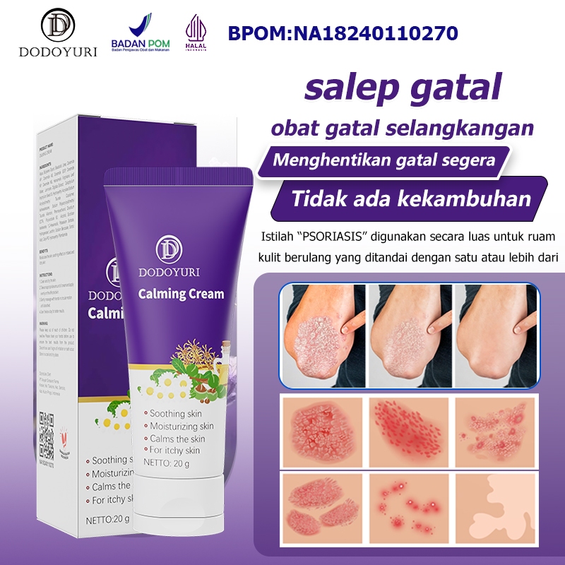 DODOYURI Obat gatal selangkangan Obat panu Salep gatal Obat kurap 20g Obat gatel Obat eksim Obat gat