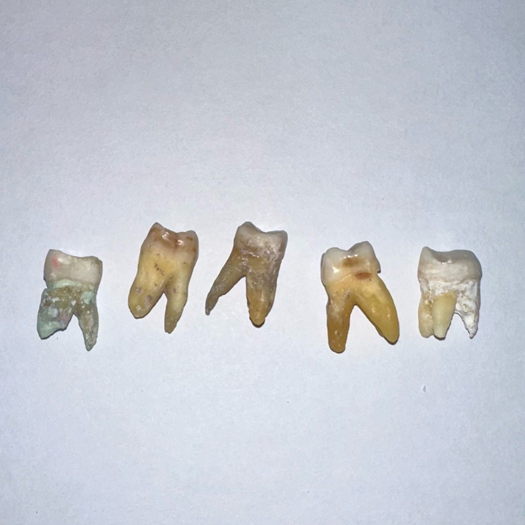 Gigi Molar Atas Asli (Praktikum FKG)