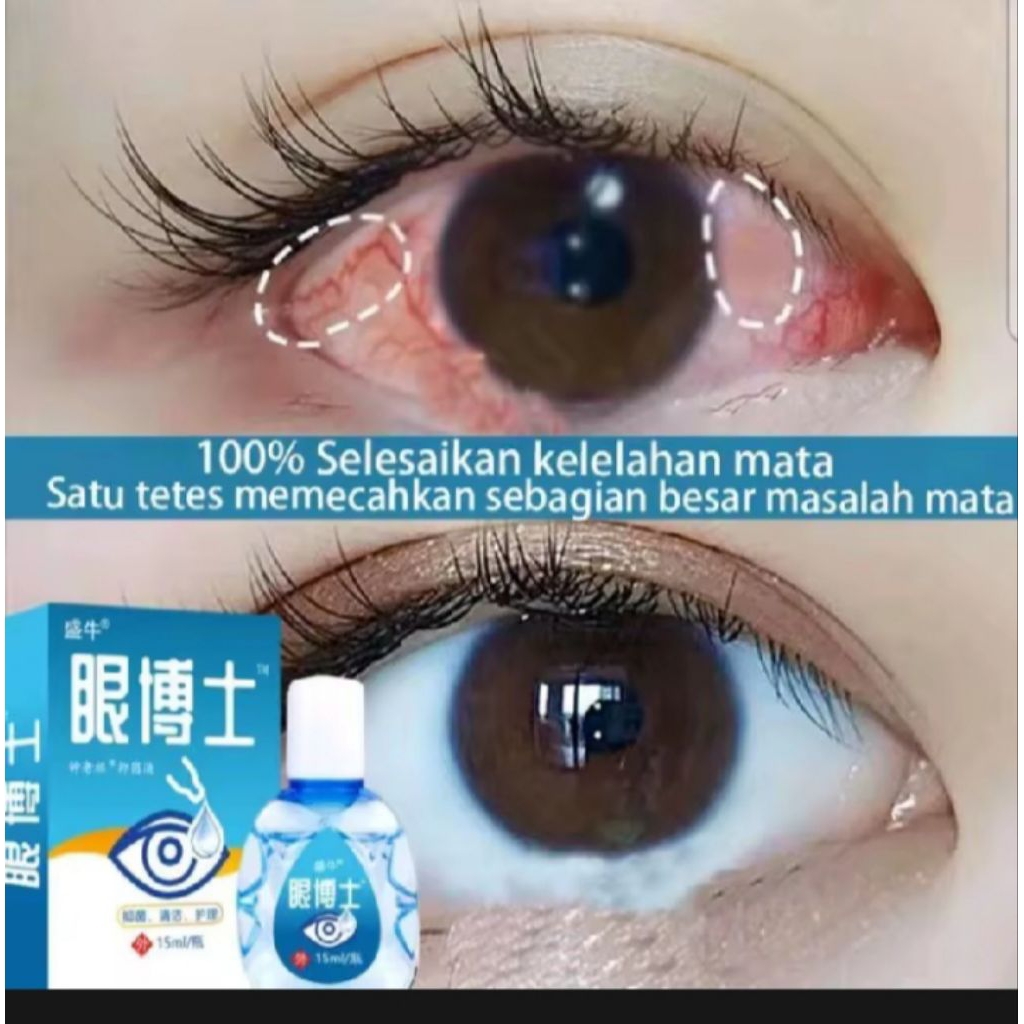 YEHUANGSU OBAT TETES MATA NO 1 JEPANG / TETES MATA JEPANG OBAT TETES MATA BERLEMAK KEKUNINGAN PTERIG