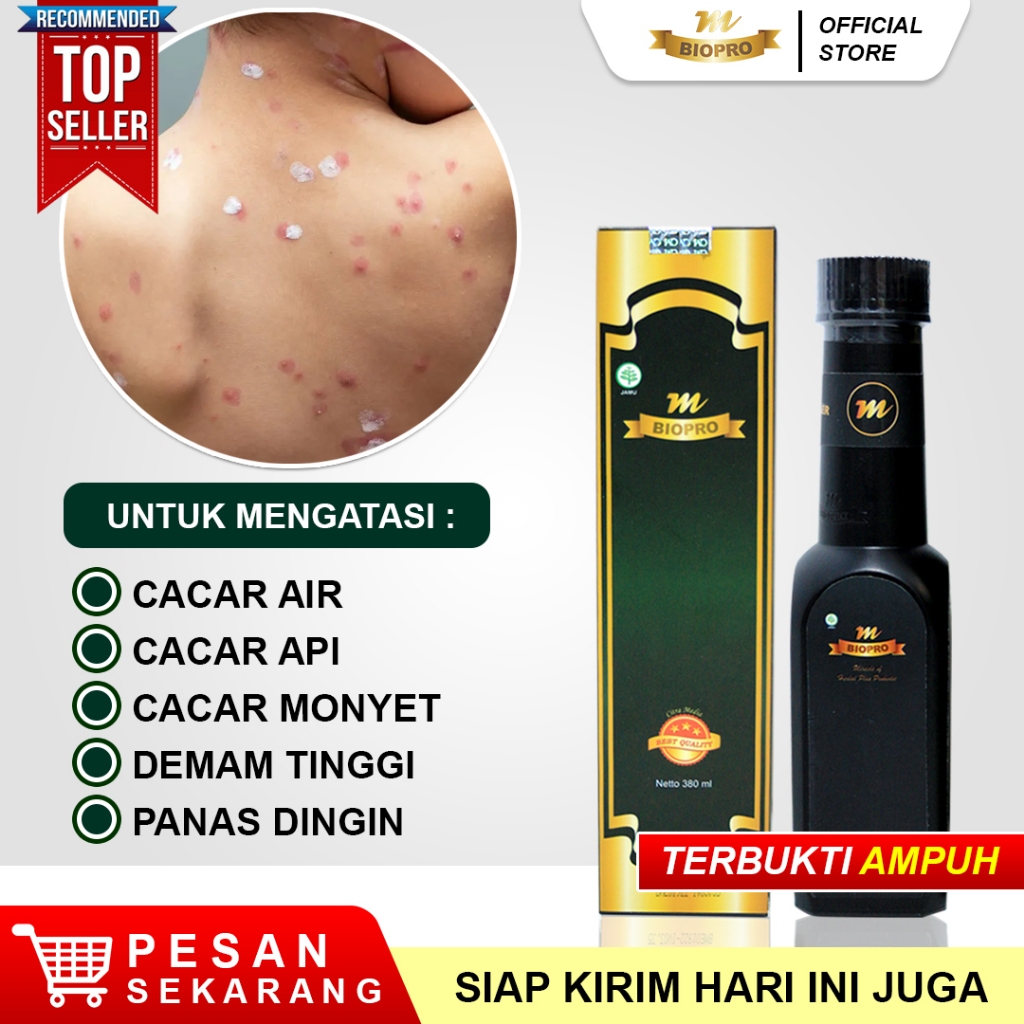 Mbiopro Obat Herbal Cacar Air, Cacar Api, Cacar Monyet, Campak, Cacar Gatal, Penghilang Bekas Cacar,