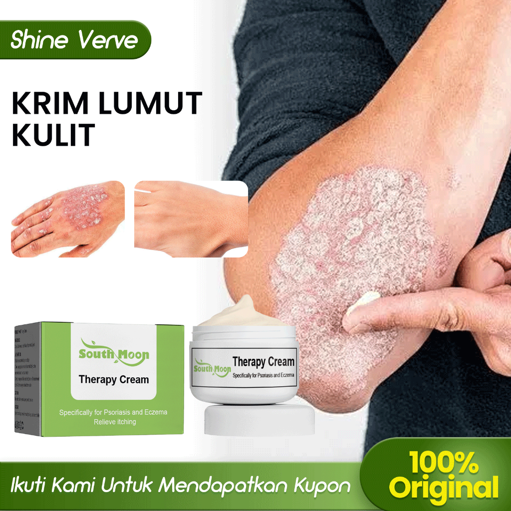 South Moon Krim Lumut Kulit 20g Anti Jamur Salep Gatal Kulit Eksim Psoriasis Cream Penghilang Gatal 
