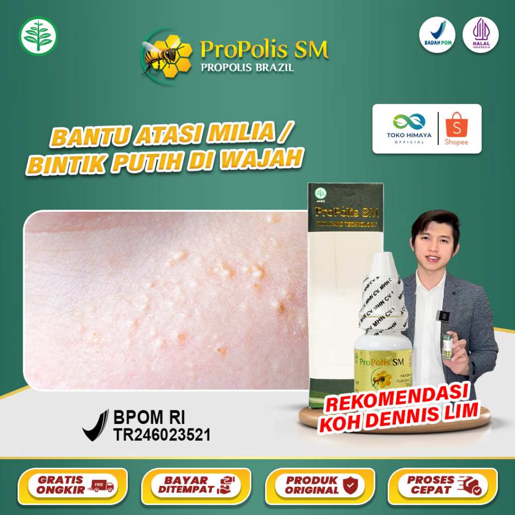 PROPOLIS SM Obat Milia Di Wajah Menghilangkan Bintik Di Bawah Mata Syringoma Bruntusan