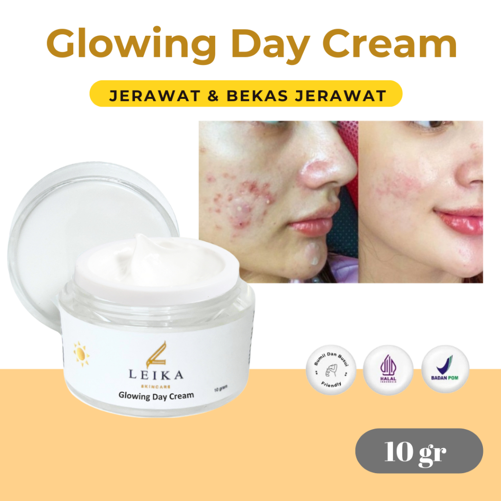 Cream Acne BPOM Cream Penghilang Jerawat dan Bekas Jerawat Ampuh Obat Jerawat Acnes Creamy Wash Ori 