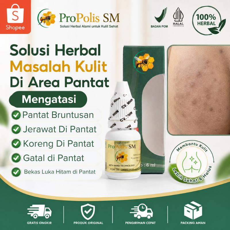 Obat Pantat Gatal, Obat Pantat Burik, Obat Pantat Bruntusan, Obat Jerawat Di Pantat, Obat Koreng Di 