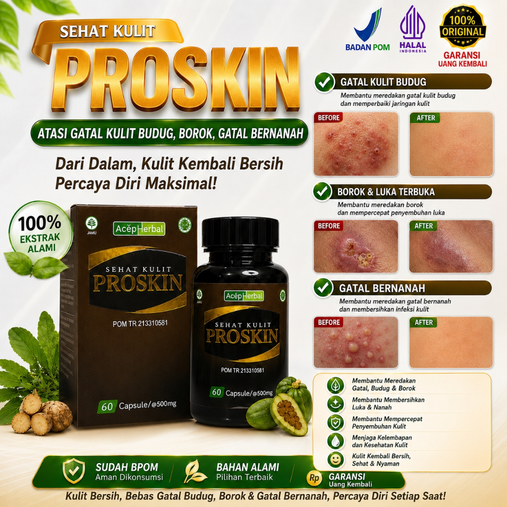 Obat Gatal, Obat Budug, Obat Borok, Oba Gatal Bernanah, Obat Budug Bernanah, Eksim, Kutu Air, Herpes