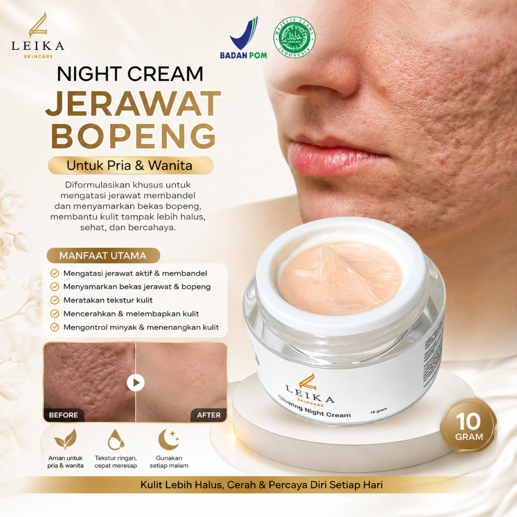 Night Cream Bekas Jerawat Bopeng Penghilang Bekas Jerawat Menghilangkan Jerawat Bopeng Bekas Jerawat