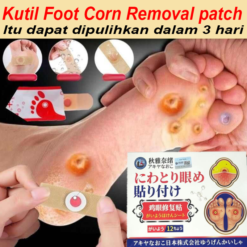 Plester Mata Ikan Paling Ampuh Jepang 0bat Mata Ikan Di Kaki Penghilang Mata Ikan Di Tangan Foot Cor