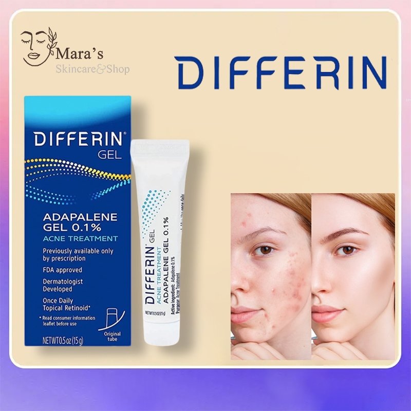 Differin Acne Treatment Gel/Differin Adapalene Gel 0.1% Acne Treatment 15g