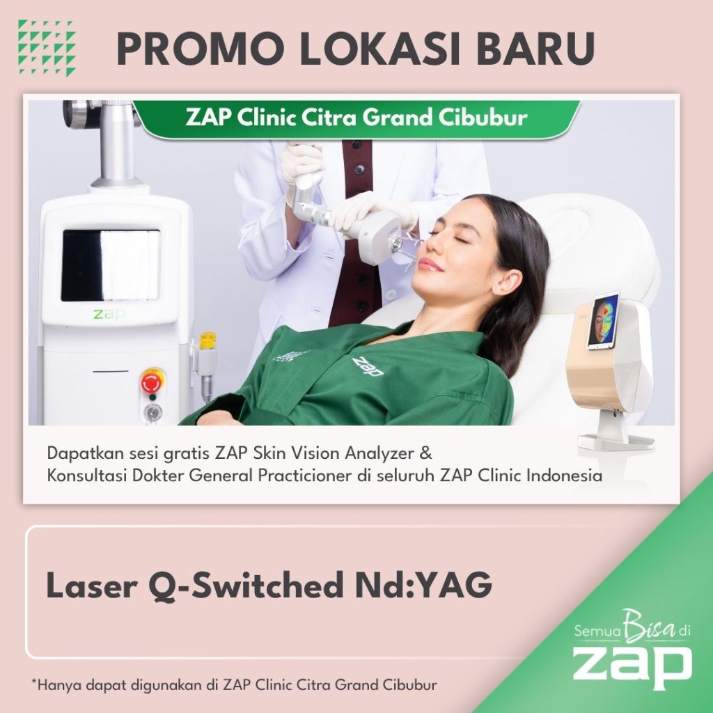 (NEW OUTLET PRESALE) Laser Q-Switched Nd:YAG (1000 shots) - ZAP Clinic Citra Grand Cibubur