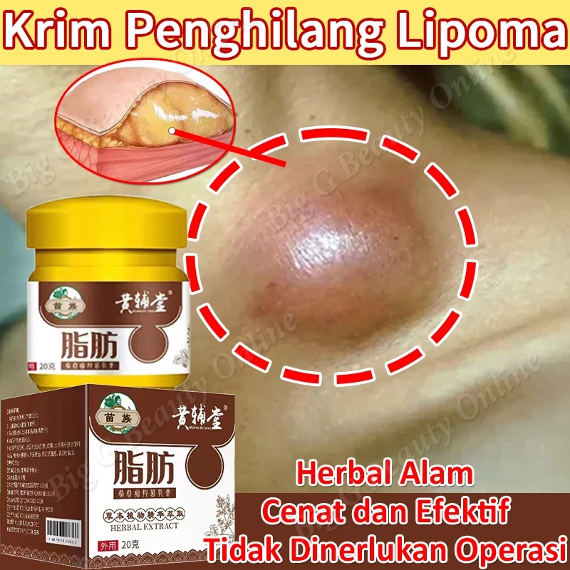 Lipoma Cream Penghilang Lemak removal Benjolan Lipoma Removal Cream Original Obat Benjolan Lipoma Kr