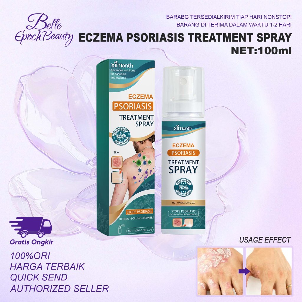 Ximonth Psoriasis Spray 100ml Eczema Spray Semprotan Eksim Antipruritus Obat Psoriasis Salep Kulit J