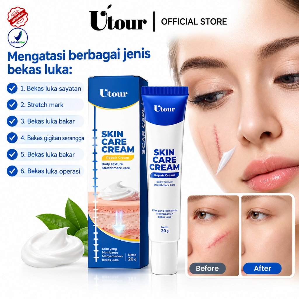 Penghilang Scar  Krim Obat Bekas Luka Luka Jahitan Bekas Luka Jerawat Dan Stretch Marks