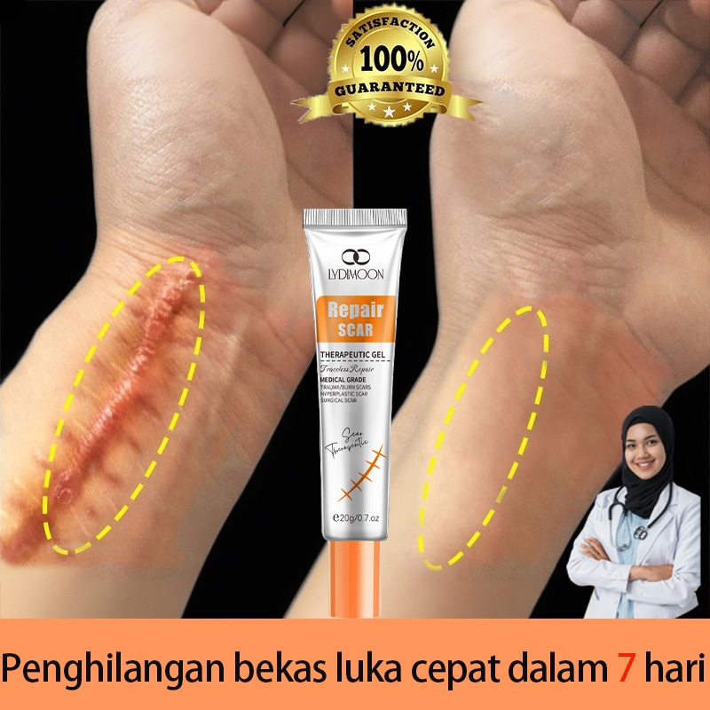 LYDIMOON krim bekas luka salep penghilang bekas luka krim penghilang koreng bekas lukaerawat/Bakar/O