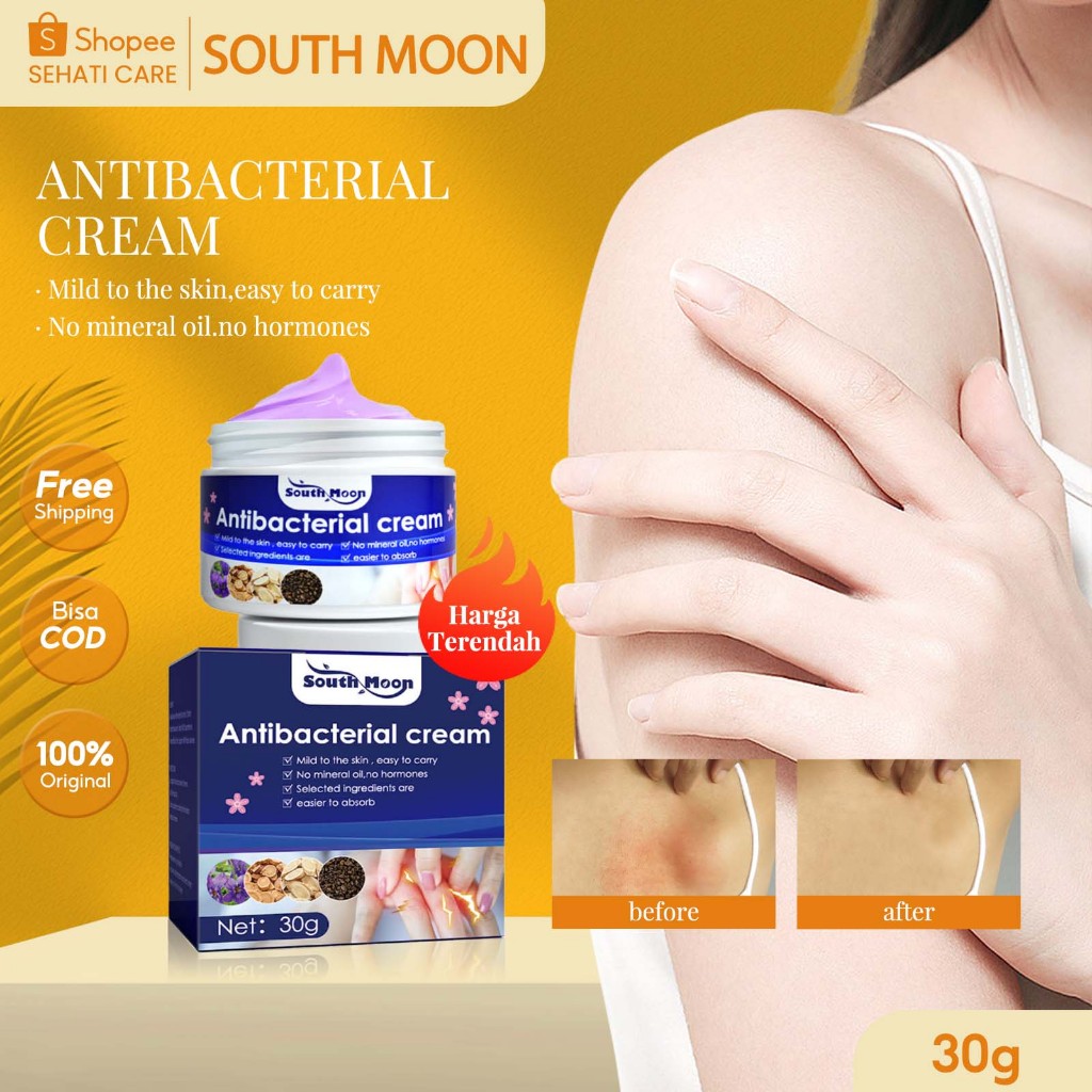 South Moon Antibacterial Cream 30g Krim Anti Gatal Viola Yedoensis Mild To The Skin Atasi Kulit Mera
