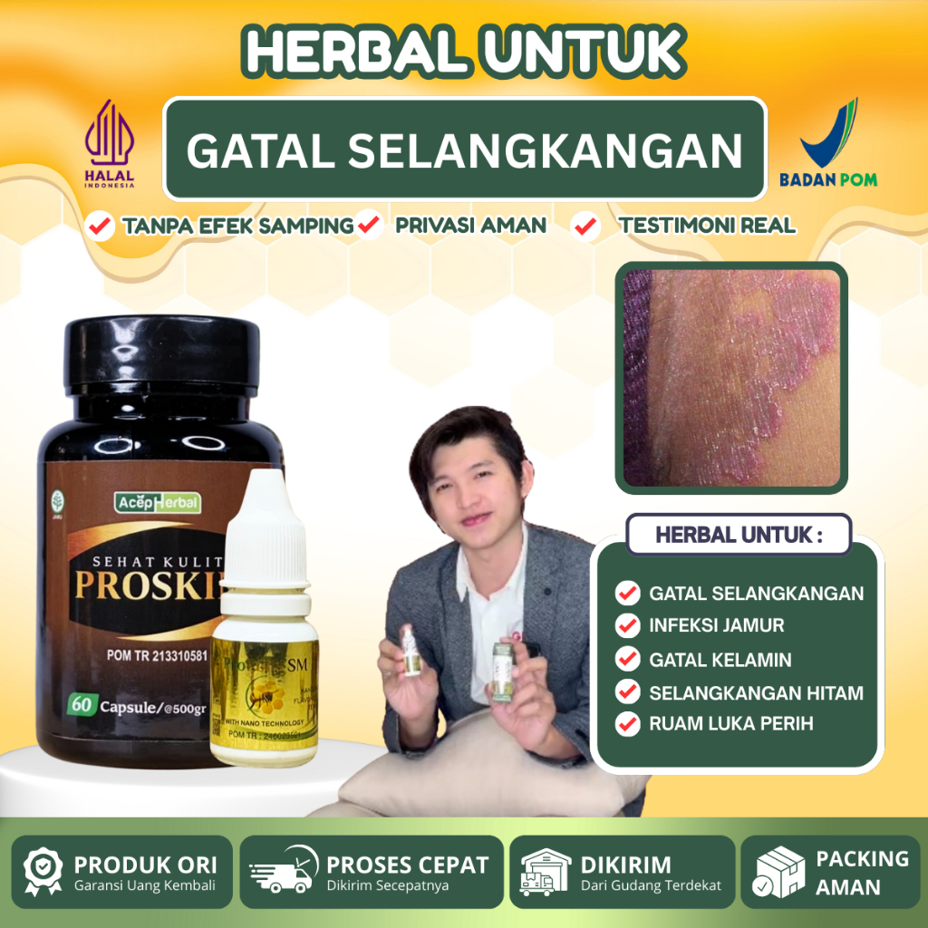 Obat Gatal Selangkangan Kelamin Tinea Cruris kurap Selangkangan Infeksi Jamur Selangkangan Gatal