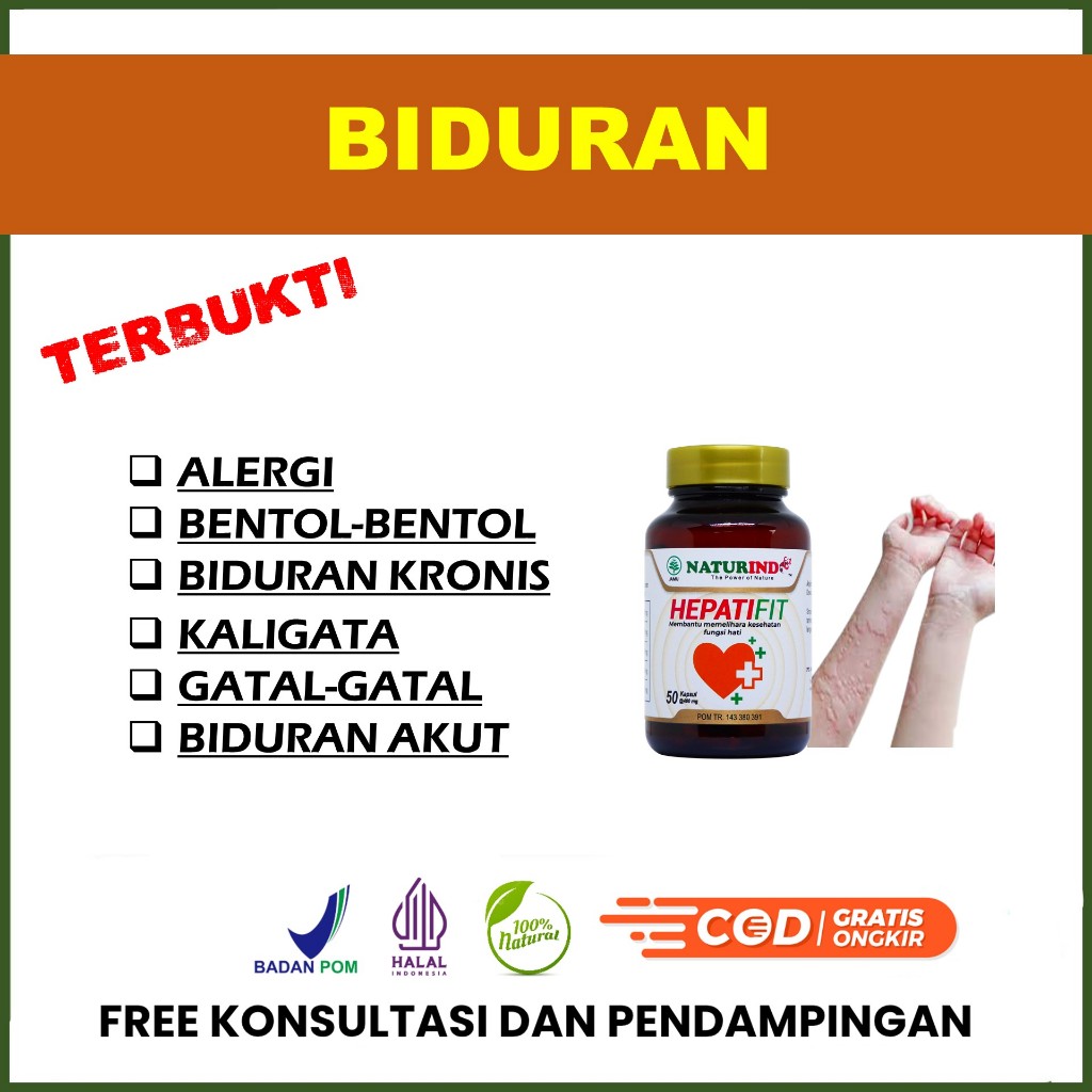 Biduran Kronis Alergi Gatal Alergi Dingin Gatal Biduran Kaligata Hepatifit BPOM Naturindo