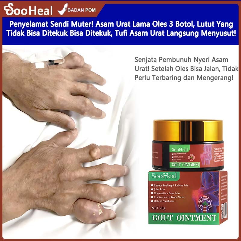20g Salep Asam Urat obat cina asam urat obat herbal asam urat obat asam urat Khusus Mengobati Gout d