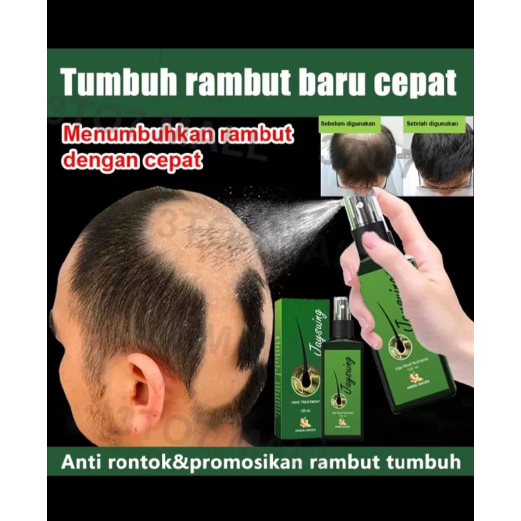 jaysuing semprotan penumbuh rambut 120 ml, melebatkan rambut, mengatasi rambut rontok
