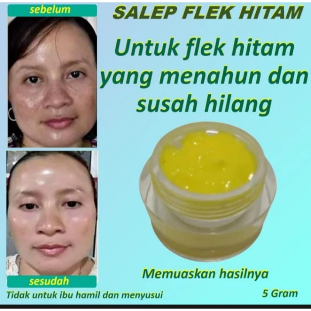 salep penghilang flek hitam tebal dan bandel