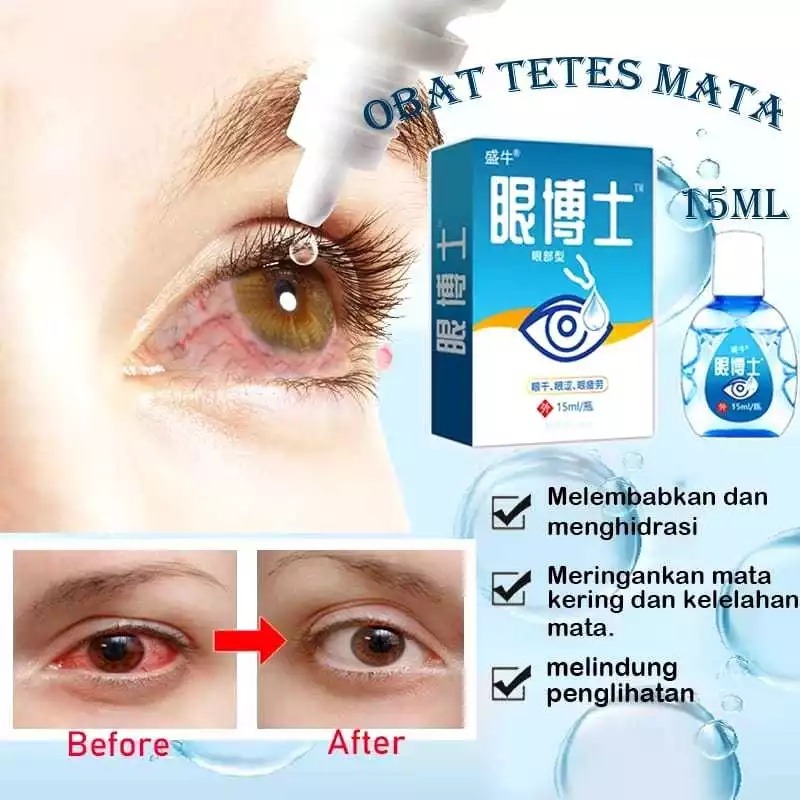 Obat Tetes Mata Anak & Dewasa Obat Mata Katarak Mata Kering Sakit Mata Darah Merah