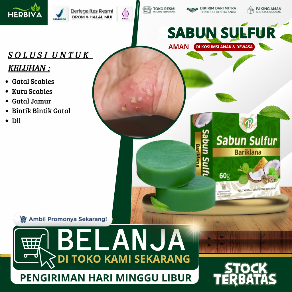 Sabun Sulfur - Obat Gatal Scabies, Sabun Scabies Manusia,Pembasmi Kudis Scabies,Gigitan Tungau,Kutu 