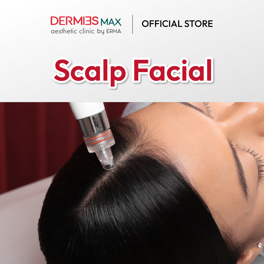 Dermies Max Scalp Facial