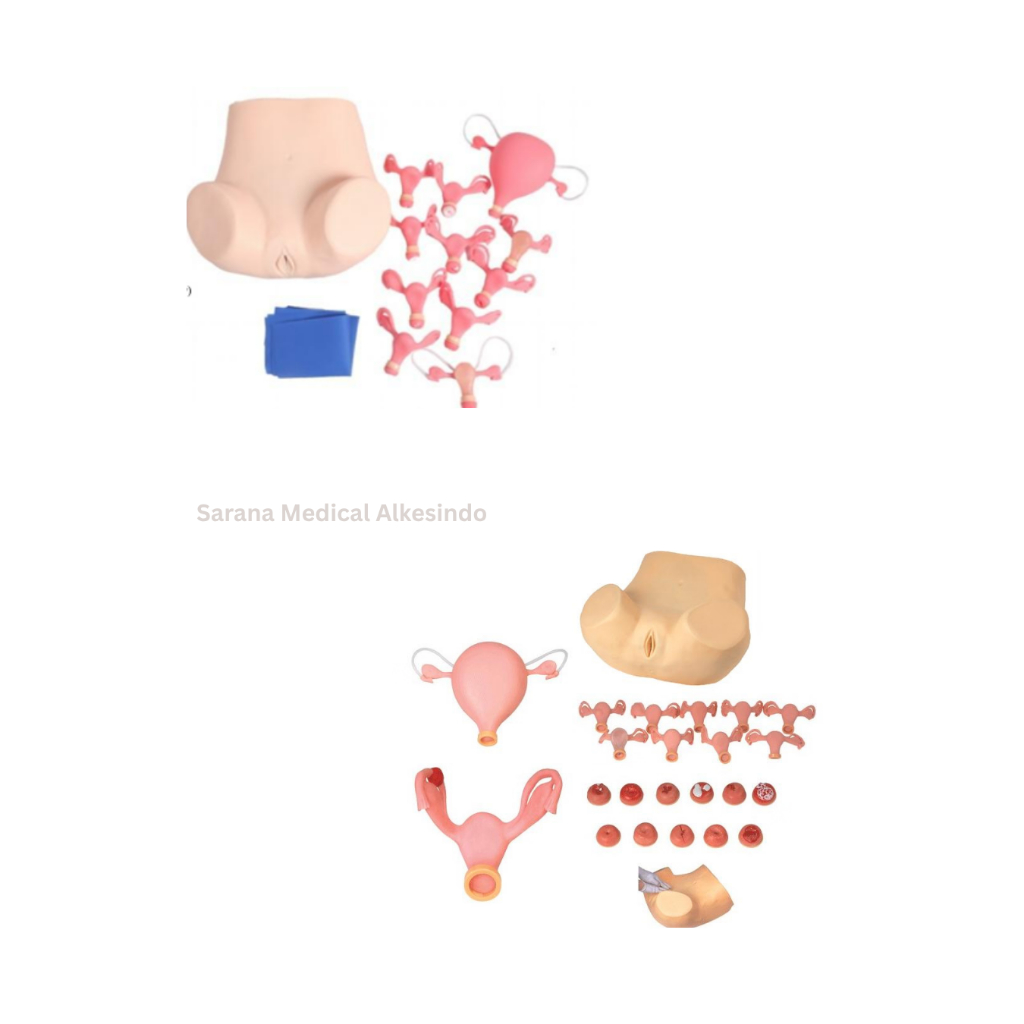 Manekin/Manikin/Alat Peraga/Phantom/Manekin Pemeriksaan Ginekologi Tingkat Lanjut – Simulasi Uterus 