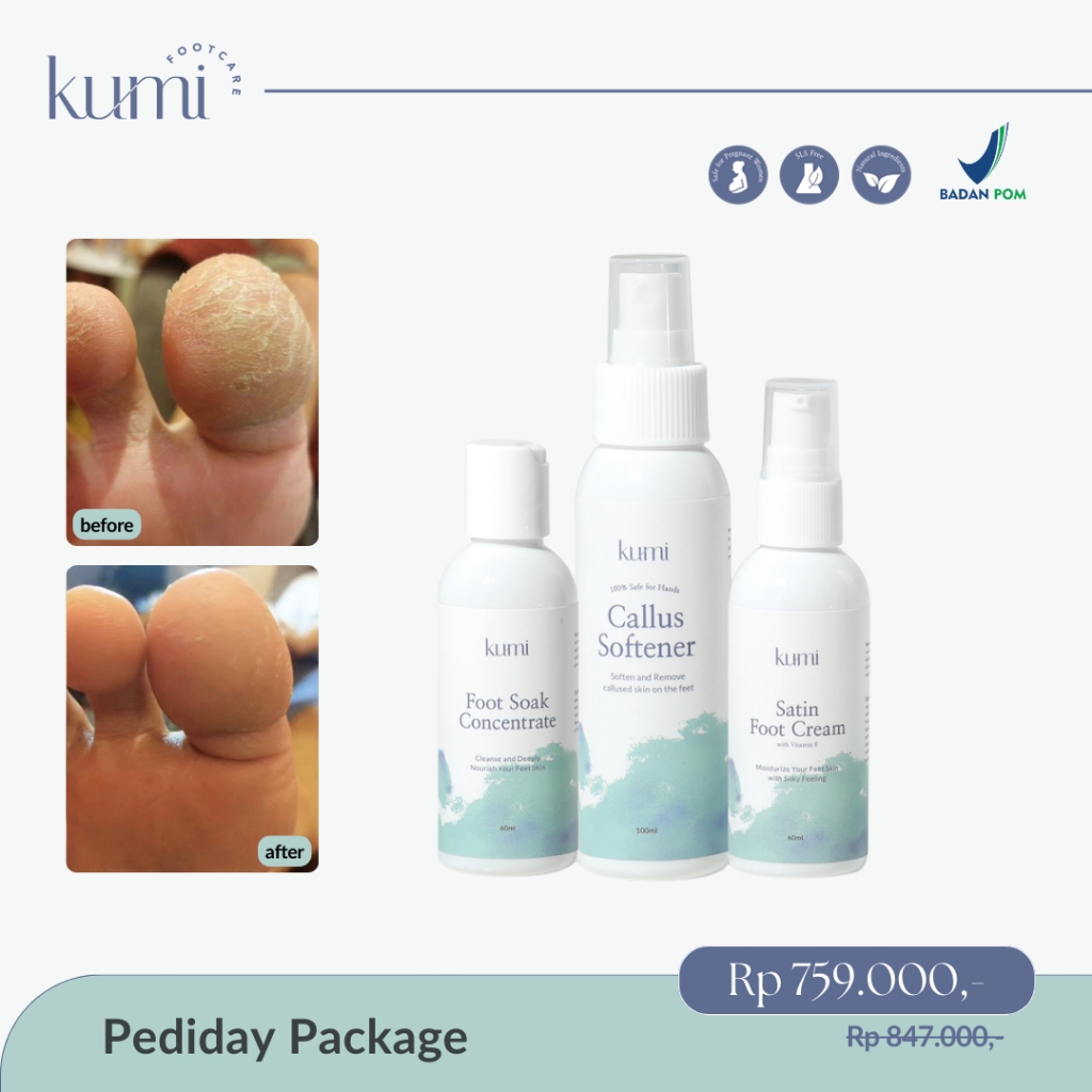 Kumi Pediday Package / Pedicure / Callus Treatment / Footcare / Kapalan / Treatment Kaki