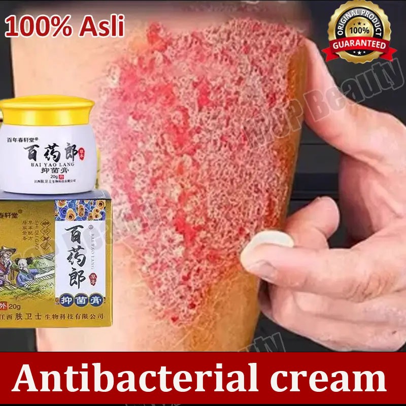 Salap gatal china salep eksim kering dan gatal salep china gatal paling ampuh salep gatal selangkang