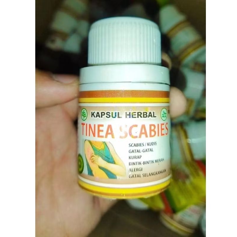 Tinea Scabies 30 Kapsul~ Mengatasi Gatal², Kurap, Kudis dll 100% Original