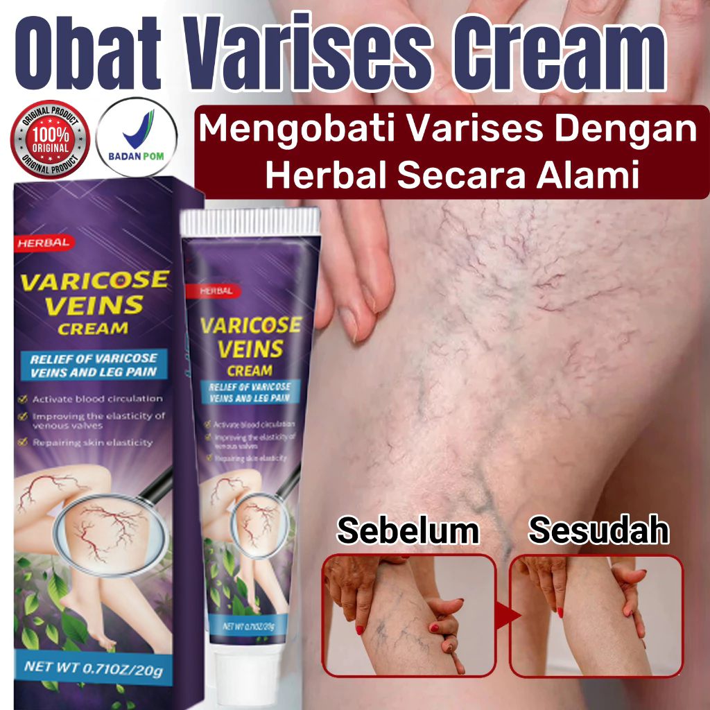 Obat varises salep varises cream varises paling ampuh original obat varises paling ampuh salep varis