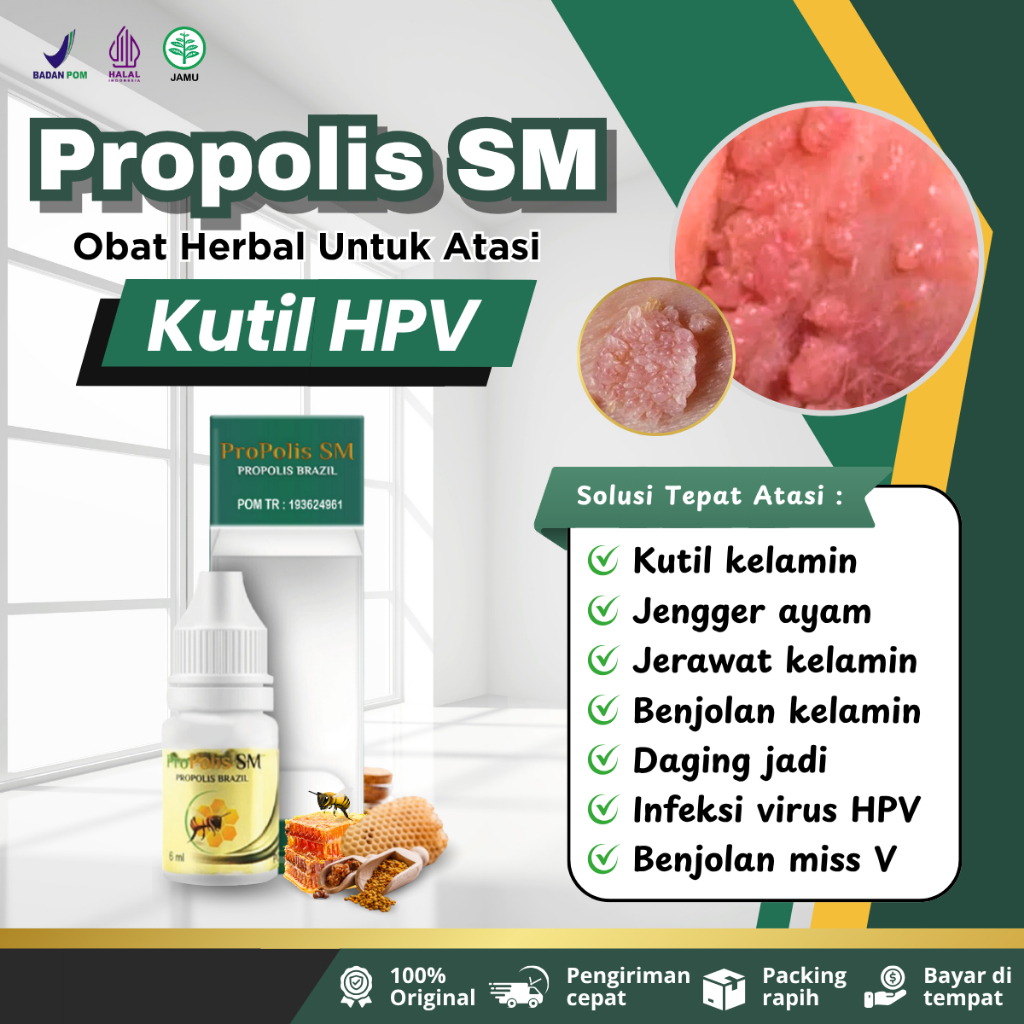 Propolis SM - Obat Untuk Atasi Kutil Kelamin, Jengger Ayam, Infeksi Virus HPV, Daging Tumbuh di Area