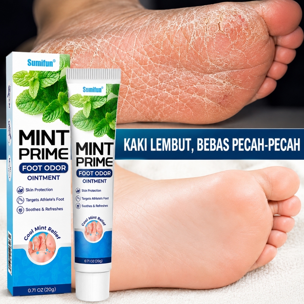 Sumifun Mint Obat kutu air 20G penghilang kutu air sobek dan terkelupas di sela-sela jari kaki Obat 