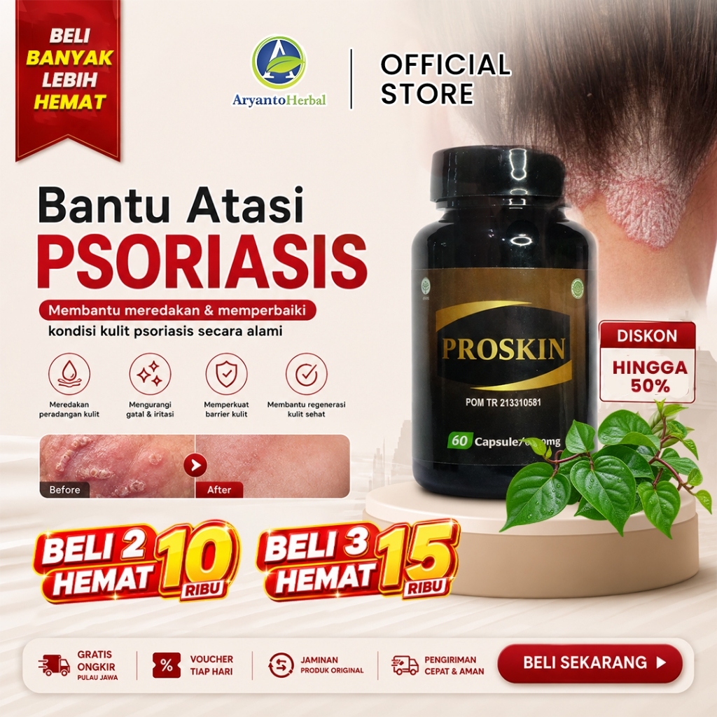 Obat Psoriasis, Herpes, Eksim Menahun, Gatal Kulit Eksim, Eksim Kering, Eksim Basah, Salep Eksim, Ek