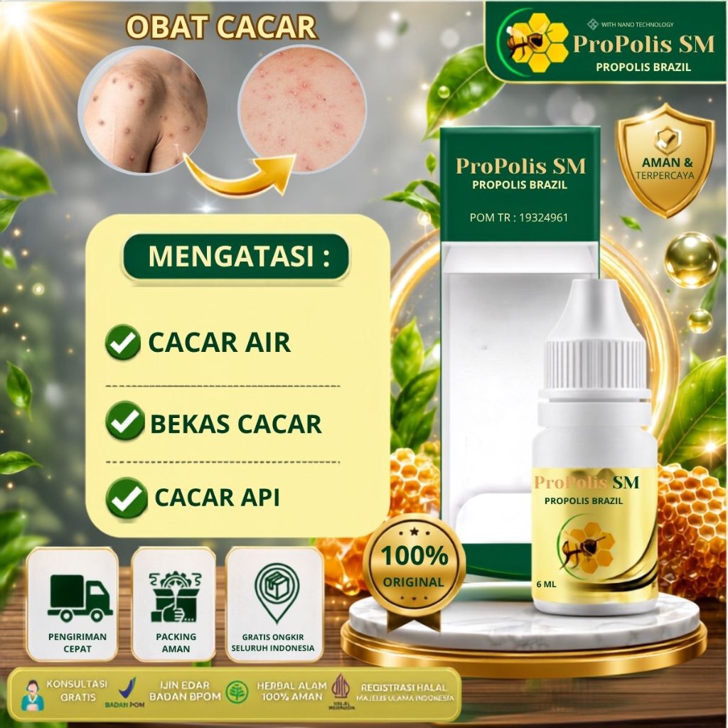 Obat Cacar Air Obat Cacar Api Obat Cacar Bintik Bintik Merah Berair Cacar Berair Campak Obat Herbal 