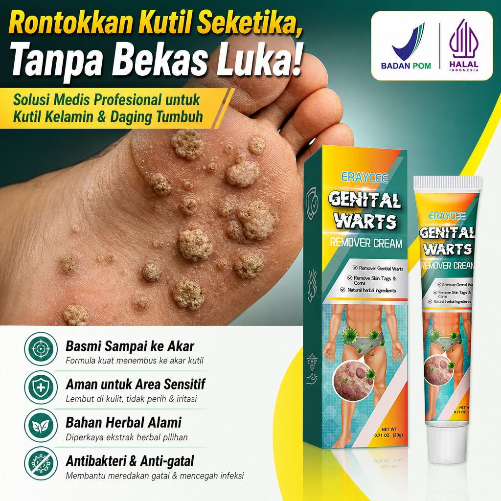 Salep untuk kutil pada jari kaki, efektif menghilangkan dan menyembuhkan kutil kelamin, kutil di sek
