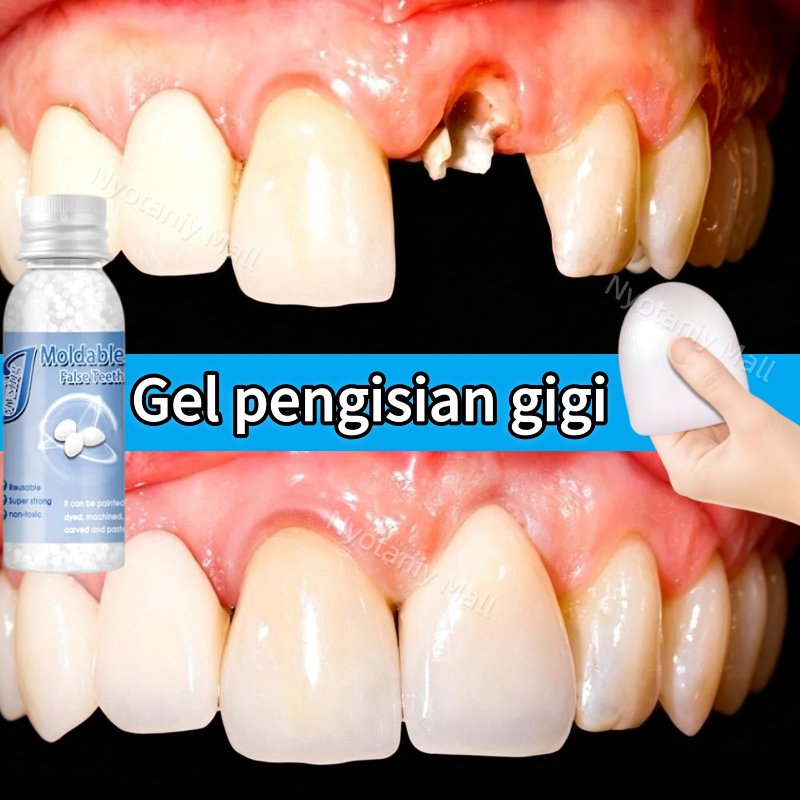Tambal gigi Penambal gigi berlubang Lem gigi Butiran penambal gigi Tambal Gigi Permanen Super Kuat B