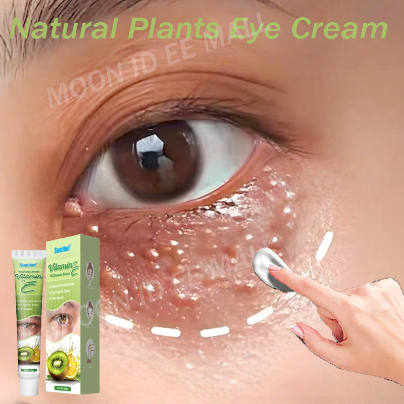 penghilang milia paling ampuh Salep milia Di Bawah Mata Eye cream Menghilangkan Milia Syringoma Xant