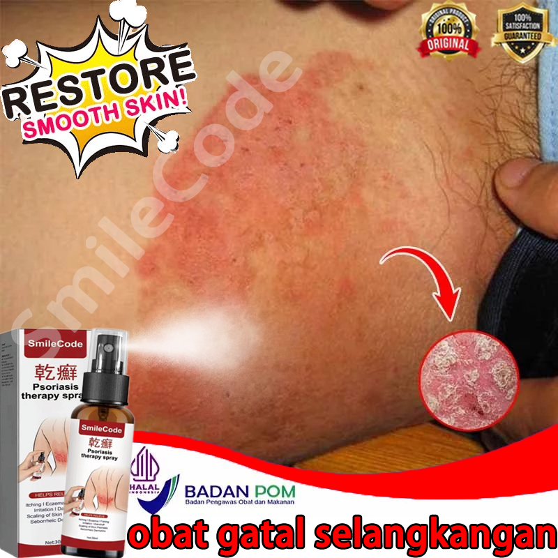 BPOM- Salep gatal paling ampuh Obat psoriasis obat gatal salep kutil Obat Gatal Salep gatal Salep ps