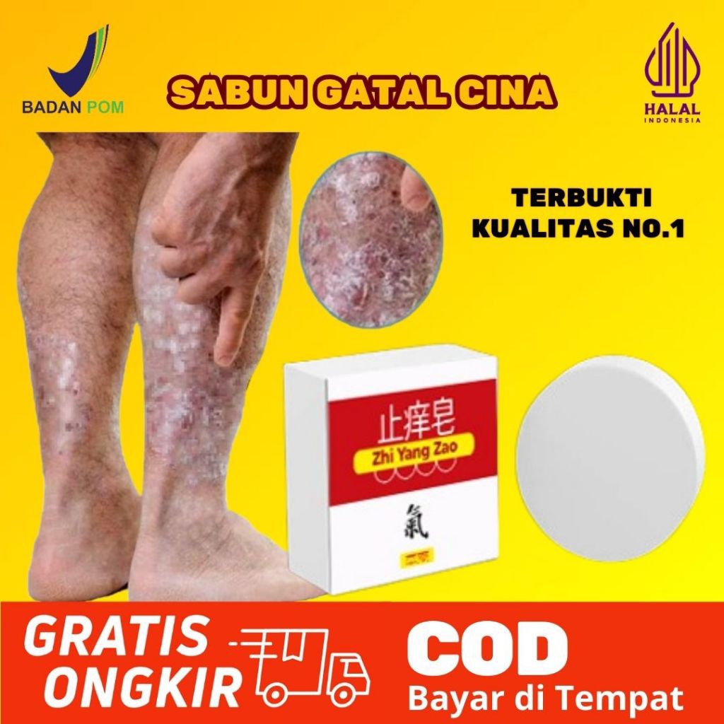 Sabun Obat Gatal Cina Herbal Alergi