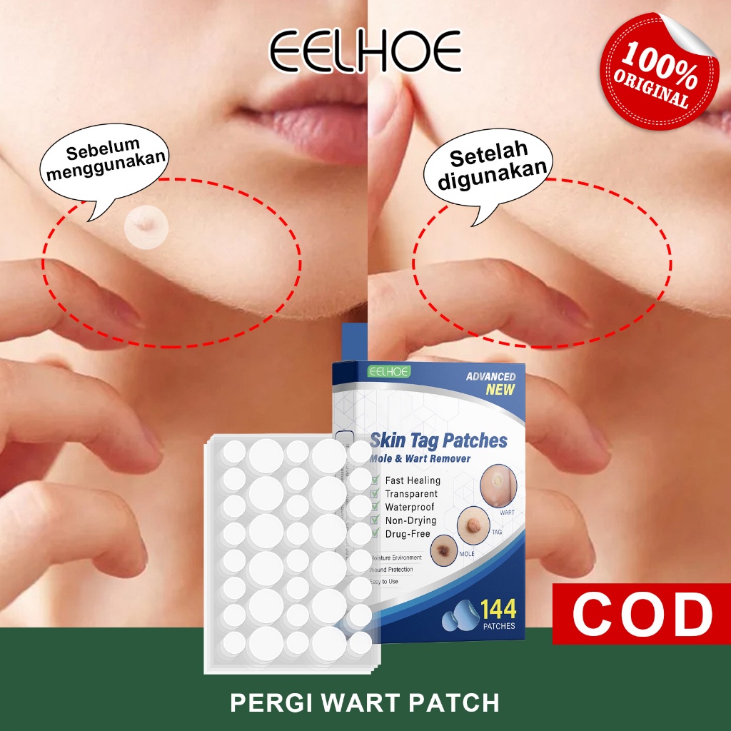 EELHOE Skin Tag Patch 144pcs Mole Wart Remover Skin Tag Remover Patch Stiker Plester Penghilang Kuti