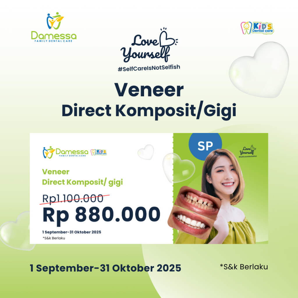 Voucher Veneer Direct Komposit/Gigi Dokter SP