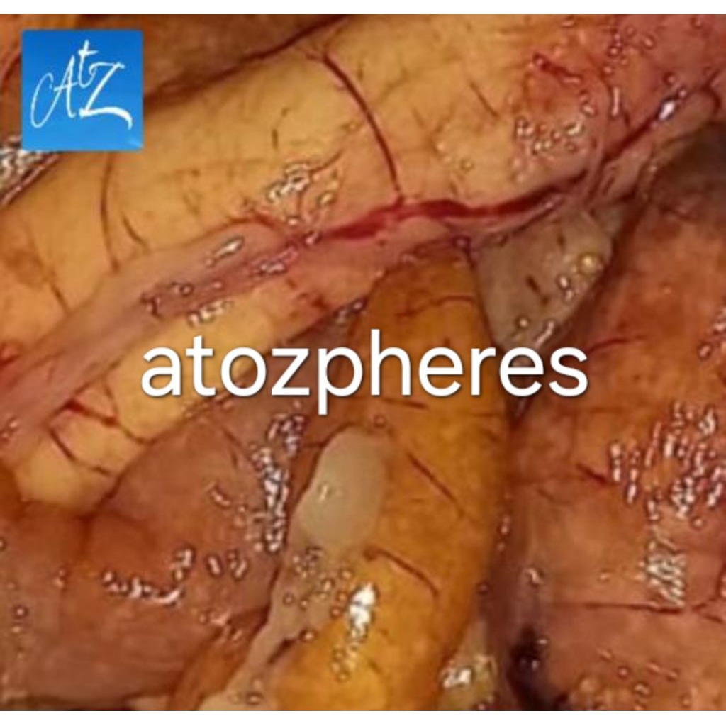 

Telur telor ikan gabus mentah segar pilihan fresh snakehead fish egg 100g