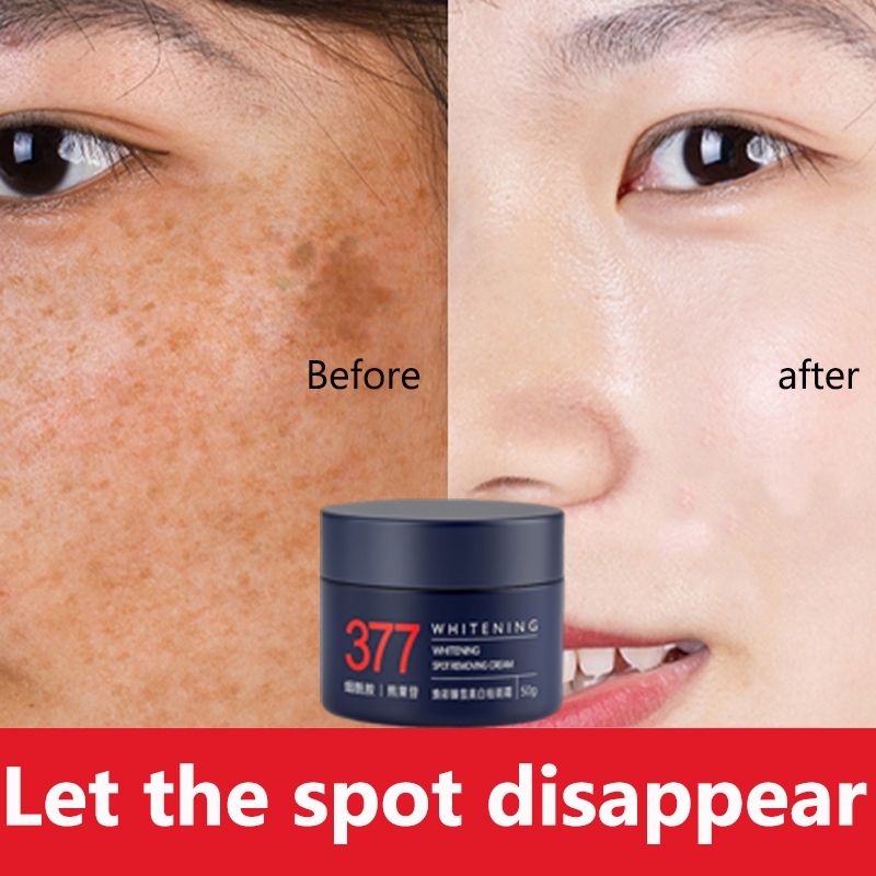 whitening freckle cream  50g  rich niacin amide  Whitening and Freckle Removing