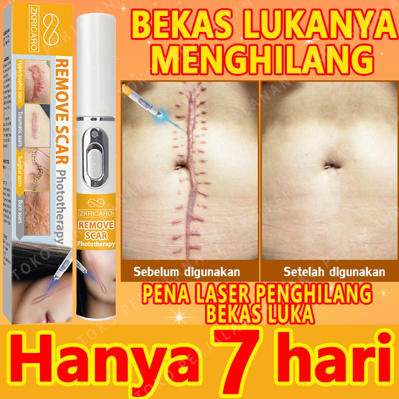 Penghilang Bekas Luka Laser Pengurangan Bekas Luka Penghilang Bekas Luka Menonjol Pengurangan Bekas 